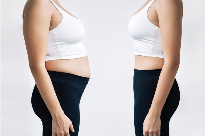 Losing Weight Pembroke Pines